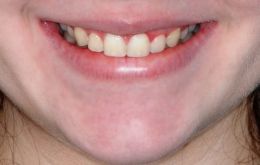Não basta pensar na boca ou nos dentes de forma isolada. Toda avaliação exige um estudo do contexto. Créditos: Arquivo Estela Maris Jurach