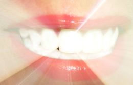 Para quem sonha com um sorriso brilhante, cuidado é palavra de ordem. Créditos: Divulgação