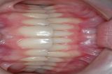 A infância é o melhor tempo para conquistar a harmonia facial. O crescimento harmônico entre as arcadas e um perfil reto é o objetivo. Créditos: Arquivo Estela