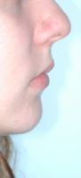 Não basta pensar na boca ou nos dentes de forma isolada. Toda avaliação exige um estudo do contexto. Créditos: Arquivo Estela Maris Jurach
