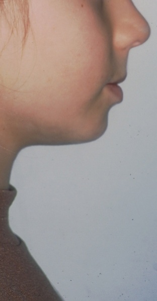 Arquivo:FotoumdenteumpaginatresPerfil 1.JPG